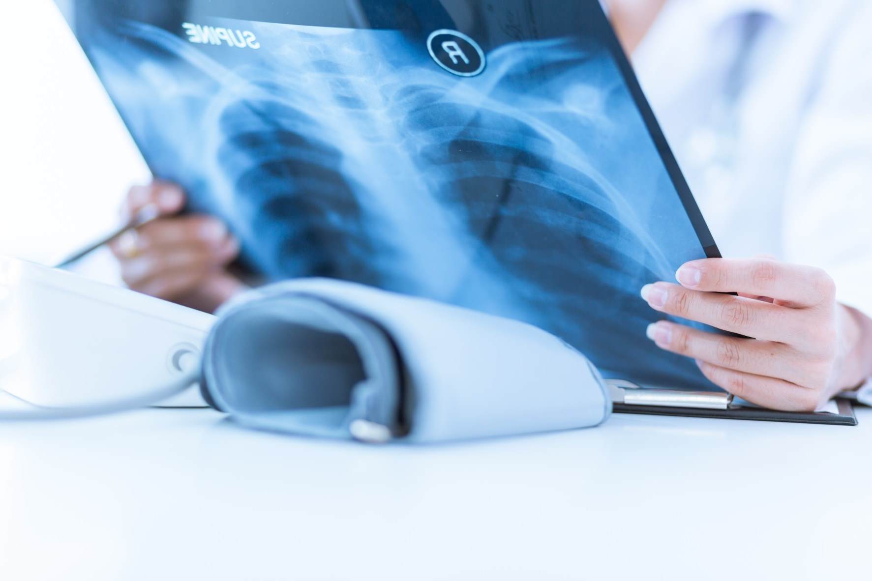 Xray of lungs and ribs